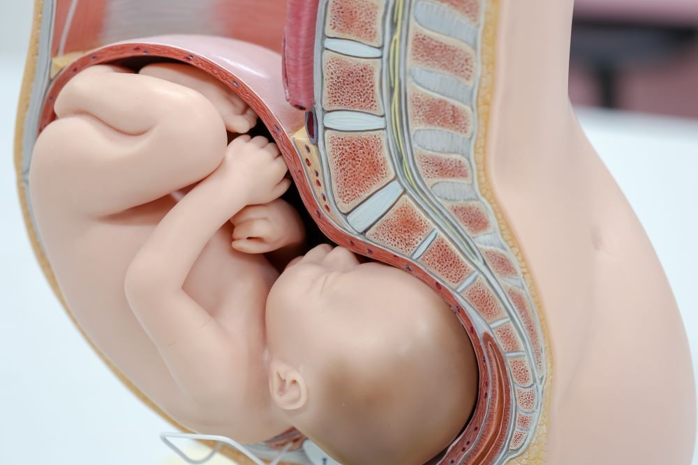 Amniocentèse une procédure sûre pour prévenir les anomalies chromosomiques.